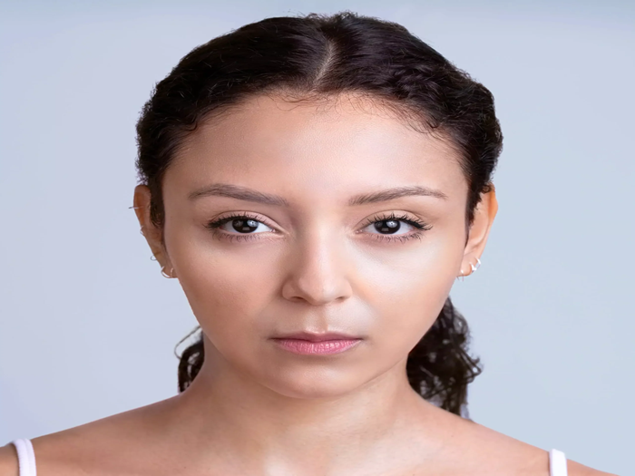 astrid-front-after-2wk@2x-scaled